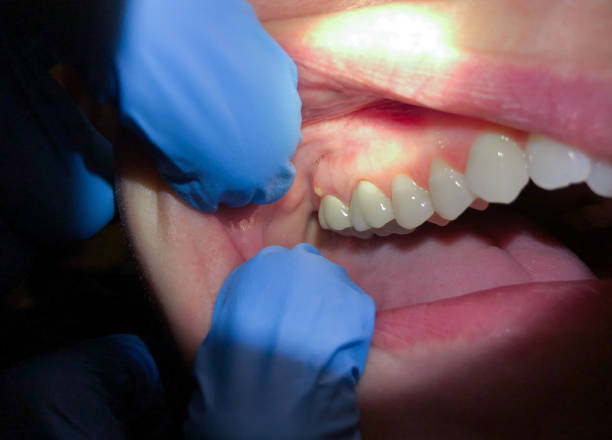 Best Pediatric Emergency Dentist in Newburgh Heights, OH